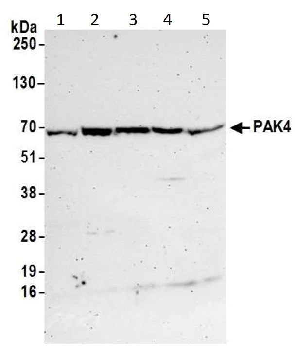 Western blot - Anti-PAK4 antibody (AB17974)