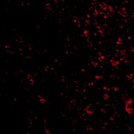 Immunocytochemistry/ Immunofluorescence - Anti-PAK4 antibody (AB62509)