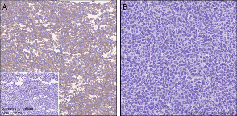 Immunohistochemistry (Formalin/PFA-fixed paraffin-embedded sections) - Anti-PAK4 antibody [EPR28630-82] (AB314765)