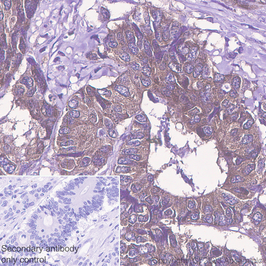 Immunohistochemistry (Formalin/PFA-fixed paraffin-embedded sections) - Anti-PAK4 antibody [EPR28630-82] - BSA and Azide free (ab314766), expandable thumbnail
