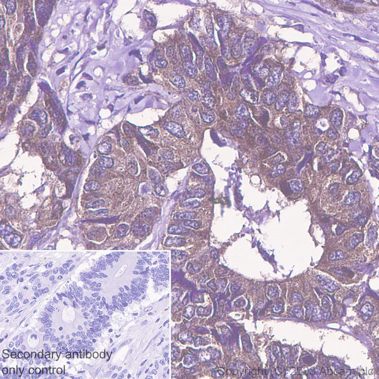Immunohistochemistry (Formalin/PFA-fixed paraffin-embedded sections) - Anti-PAK4 antibody [EPR28630-82] - BSA and Azide free (AB314766)