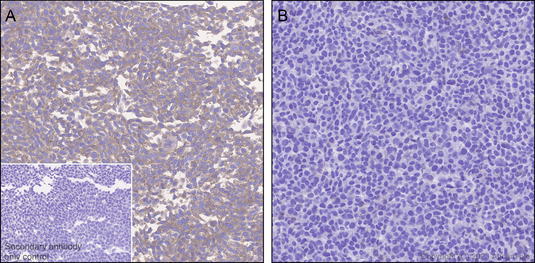 Immunohistochemistry (Formalin/PFA-fixed paraffin-embedded sections) - Anti-PAK4 antibody [EPR28630-82] - BSA and Azide free (ab314766), expandable thumbnail