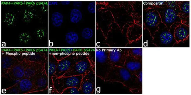 Immunocytochemistry/ Immunofluorescence - Anti-PAK4 (phospho S474) + PAK5 (phospho S474) + PAK6 (phospho S474) Antibody [RP23040229] (AB313491)