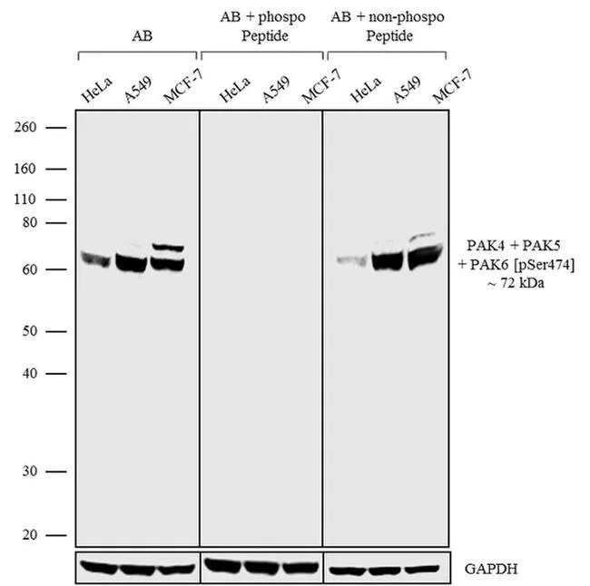 Western blot - Anti-PAK4 (phospho S474) + PAK5 (phospho S474) + PAK6 (phospho S474) Antibody [RP23040229] (AB313491)
