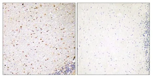 Immunohistochemistry (Formalin/PFA-fixed paraffin-embedded sections) - Anti-PAK5 antibody (AB110069)