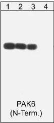 Western blot - Anti-PAK6 antibody (AB41431)
