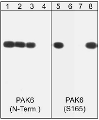 Western blot - Anti-PAK6 (phospho S165) antibody (AB41432)