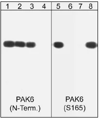 Western blot - Anti-PAK6 (phospho S165) antibody (AB41432)