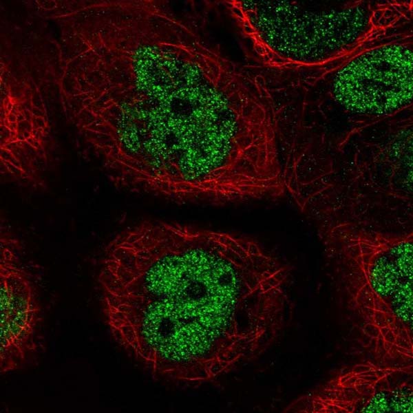 Immunocytochemistry/ Immunofluorescence - Anti-PALB2 antibody (AB220861)
