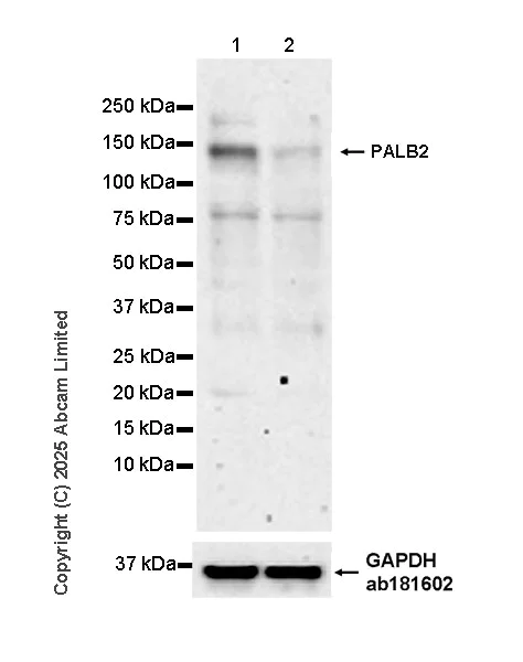 Western blot - Anti-PALB2 antibody [EPR26990-22] (AB325017)