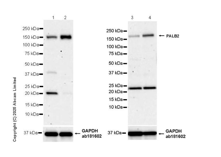 Western blot - Anti-PALB2 antibody [EPR26990-22] (AB325017)