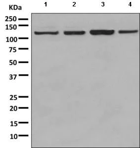 Western blot - Anti-Palladin antibody [EPR9460(B)] - BSA and Azide free (AB249133)