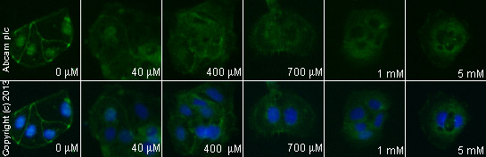 Functional Studies - (±)-Palmitoylcarnitine chloride, Protein kinase C (PKC) inhibitor (AB141122), expandable thumbnail