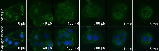 Functional Studies - (±)-Palmitoylcarnitine chloride, Protein kinase C (PKC) inhibitor (AB141122)
