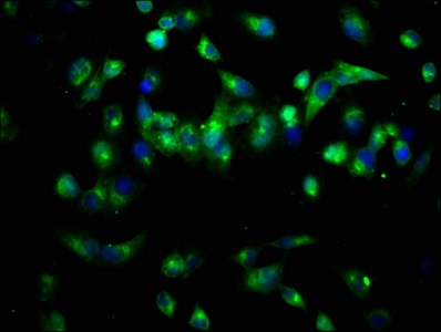 Immunocytochemistry/ Immunofluorescence - Anti-PAM/Peptidyl-glycine alpha-amidating monooxygenase antibody (AB237488)