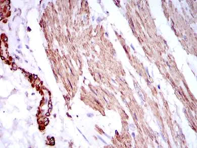 Immunohistochemistry (Formalin/PFA-fixed paraffin-embedded sections) - Anti-pan Actin Antibody [4A4] (AB119952)