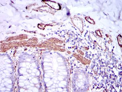 Immunohistochemistry (Formalin/PFA-fixed paraffin-embedded sections) - Anti-pan Actin Antibody [4A4] (AB119952)