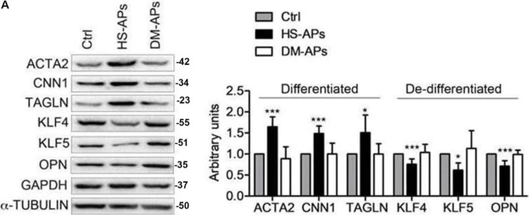 Western blot - Anti-pan Actin Antibody [4A4] (AB119952)