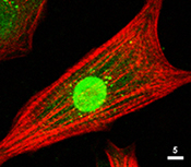 Immunocytochemistry/ Immunofluorescence - Anti-pan-AKT antibody (AB8805), expandable thumbnail