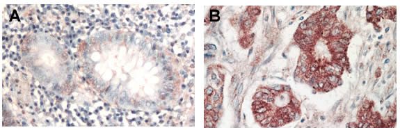 Immunohistochemistry (Formalin/PFA-fixed paraffin-embedded sections) - Anti-pan-AKT antibody (AB8805), expandable thumbnail
