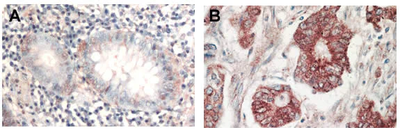 Immunohistochemistry (Formalin/PFA-fixed paraffin-embedded sections) - Anti-pan-AKT antibody (AB8805)