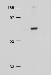 Western blot - Anti-pan-AKT antibody (AB8805), expandable thumbnail