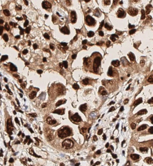 Immunohistochemistry (Formalin/PFA-fixed paraffin-embedded sections) - Anti-pan-AKT (phospho T308) antibody (AB8933)