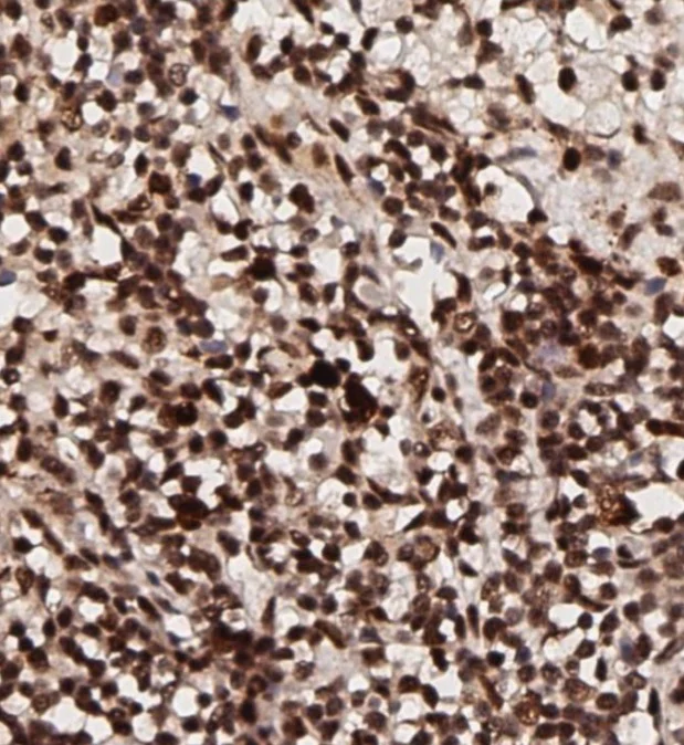 Immunohistochemistry (Formalin/PFA-fixed paraffin-embedded sections) - Anti-pan-AKT (phospho T308) antibody (AB8933)