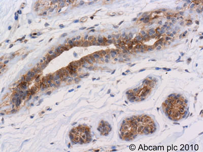 Immunohistochemistry (Formalin/PFA-fixed paraffin-embedded sections) - Anti-pan-AKT (phospho T308) antibody (AB8933), expandable thumbnail