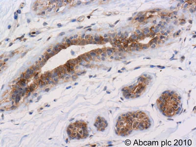 Immunohistochemistry (Formalin/PFA-fixed paraffin-embedded sections) - Anti-pan-AKT (phospho T308) antibody (AB8933)