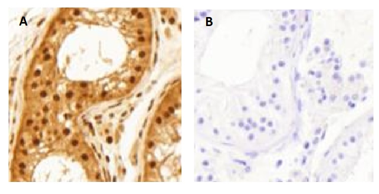 Immunohistochemistry (Formalin/PFA-fixed paraffin-embedded sections) - Anti-pan-AKT (phospho T308) antibody (AB8933), expandable thumbnail