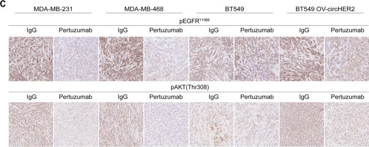 Immunohistochemistry - Anti-pan-AKT (phospho T308) antibody (AB8933)