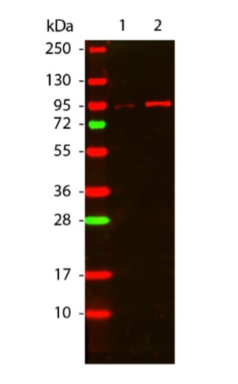 Western blot - Anti-pan-AKT (phospho T308) antibody (ab8933), expandable thumbnail