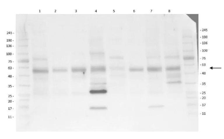 Western blot - Anti-pan-AKT (phospho T308) antibody (AB8933)