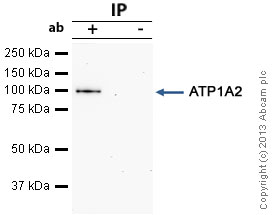 Immunoprecipitation - Anti-pan ATPase Alpha antibody [M7-PB-E9] - Plasma Membrane Loading Control (AB2871), expandable thumbnail