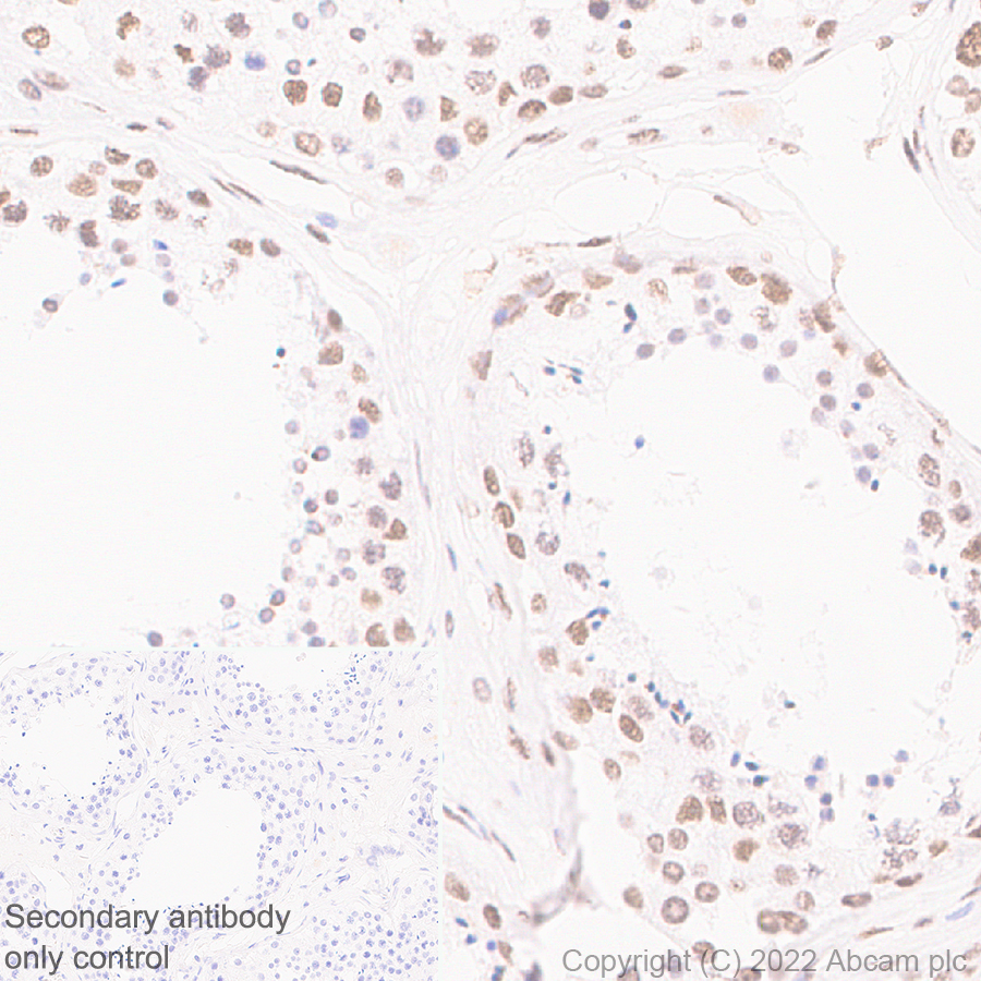 Immunohistochemistry (Formalin/PFA-fixed paraffin-embedded sections) - Anti-pan Brd4 antibody [EPR25424-71] - BSA and Azide free (AB314433), expandable thumbnail