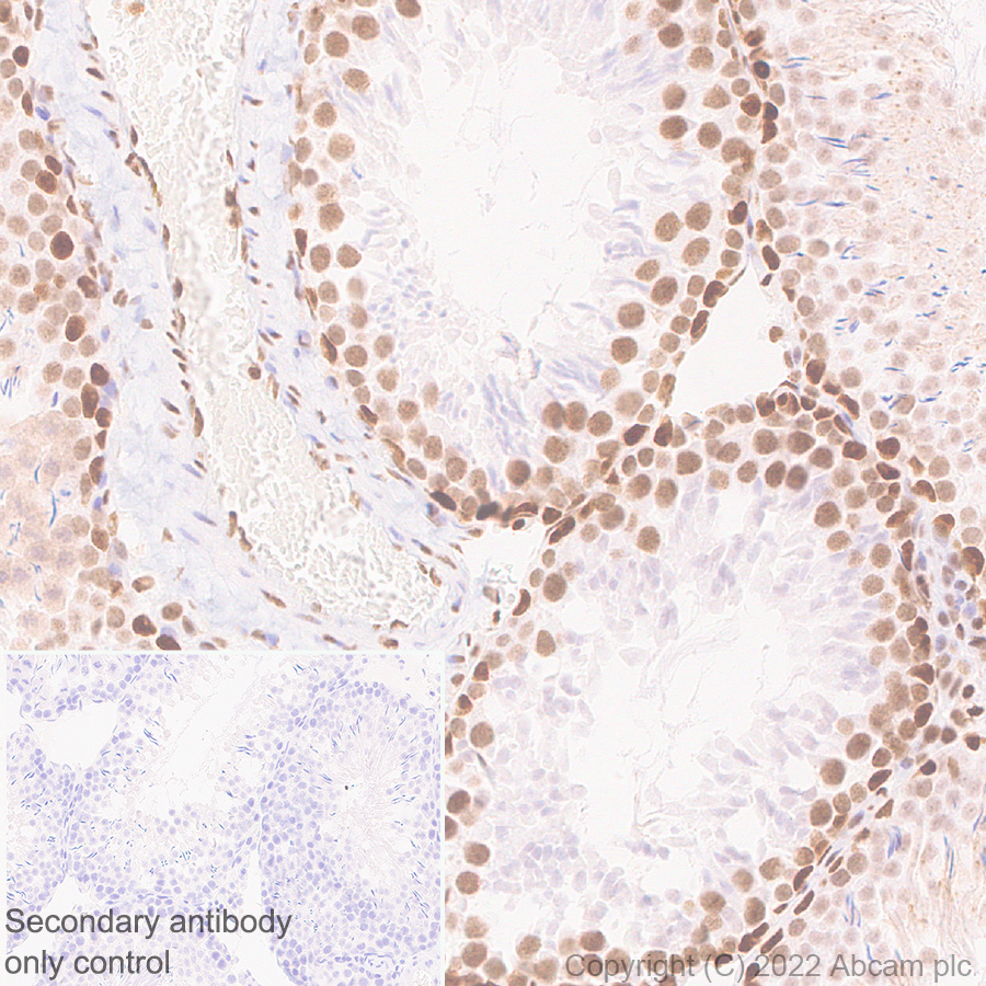 Immunohistochemistry (Formalin/PFA-fixed paraffin-embedded sections) - Anti-pan Brd4 antibody [EPR25424-71] - BSA and Azide free (AB314433), expandable thumbnail
