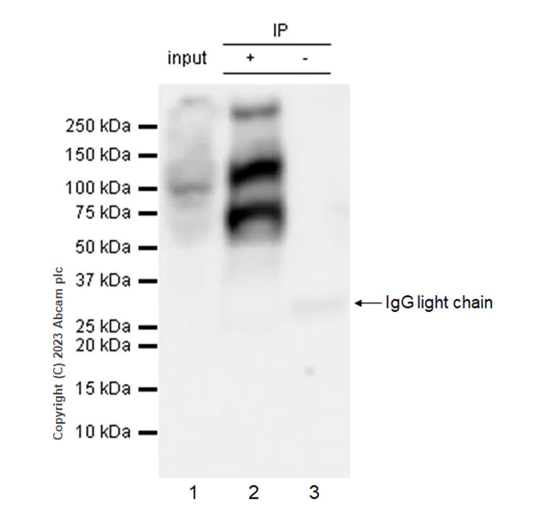 Immunoprecipitation - Anti-pan Brd4 antibody [EPR25424-71] - BSA and Azide free (AB314433)