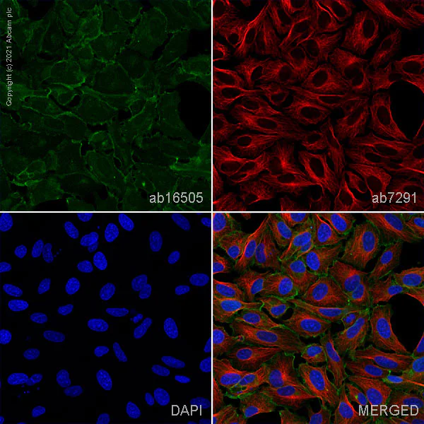 Immunocytochemistry/ Immunofluorescence - Anti-pan Cadherin antibody (AB16505)