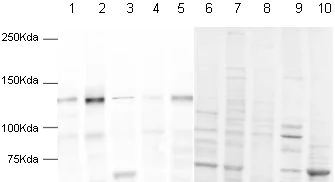 Western blot - Anti-pan Cadherin antibody (AB16505)