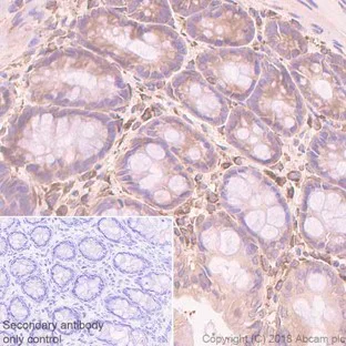 Immunohistochemistry (Formalin/PFA-fixed paraffin-embedded sections) - Anti-pan Cadherin antibody [EPR1792Y] - Intercellular Junction Marker (AB51034)
