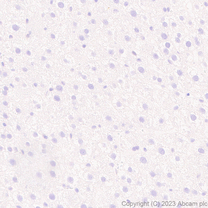 Immunohistochemistry (Formalin/PFA-fixed paraffin-embedded sections) - Anti-Pan Cav2 antibody [EPR28073-84] (AB315092), expandable thumbnail