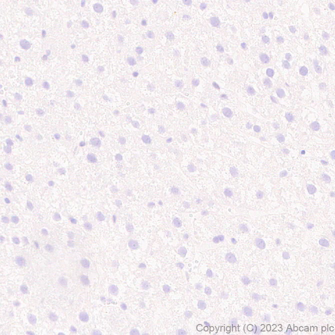 Immunohistochemistry (Formalin/PFA-fixed paraffin-embedded sections) - Anti-Pan Cav2 antibody [EPR28073-84] (AB315092)