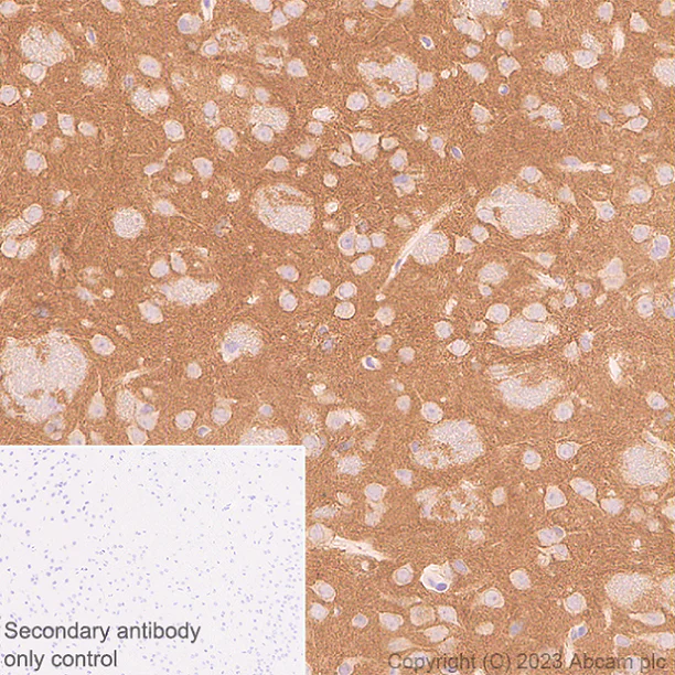Immunohistochemistry (Formalin/PFA-fixed paraffin-embedded sections) - Anti-Pan Cav2 antibody [EPR28073-84] - BSA and Azide free (AB315093)