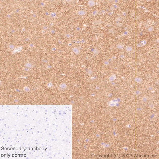 Immunohistochemistry (Formalin/PFA-fixed paraffin-embedded sections) - Anti-Pan Cav2 antibody [EPR28073-84] - BSA and Azide free (AB315093)