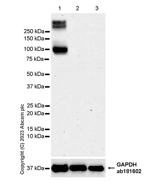 Western blot - Anti-Pan Cav2 antibody [EPR28073-84] - BSA and Azide free (AB315093)