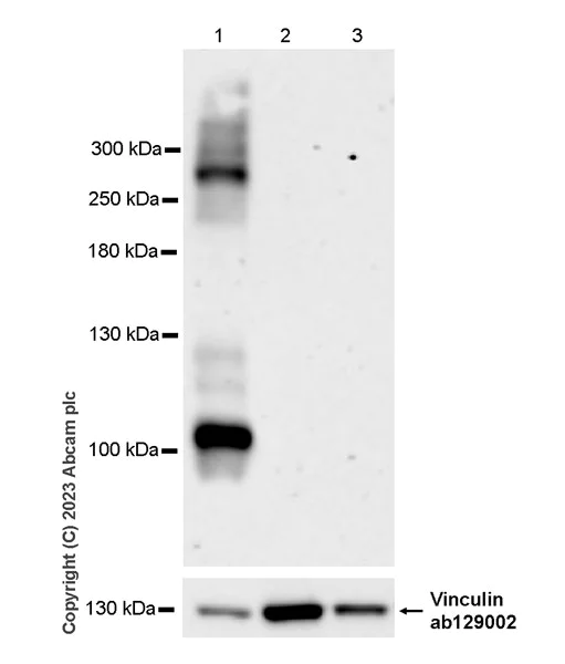Western blot - Anti-Pan Cav2 antibody [EPR28073-84] - BSA and Azide free (AB315093)