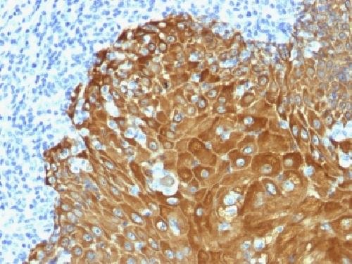 Immunohistochemistry (Formalin/PFA-fixed paraffin-embedded sections) - Anti-pan Cytokeratin antibody (AB217916), expandable thumbnail
