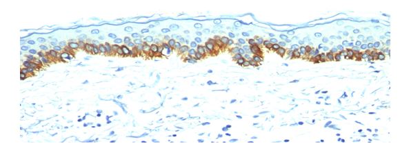 Immunohistochemistry (Formalin/PFA-fixed paraffin-embedded sections) - Anti-pan Cytokeratin antibody [AE-1] - BSA and Azide free (AB213135)