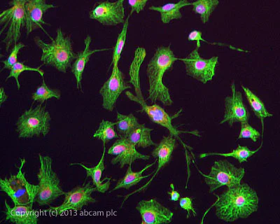 Immunocytochemistry/ Immunofluorescence - Anti-pan Cytokeratin antibody [AE1/AE3 + 5D3] (AB86734)